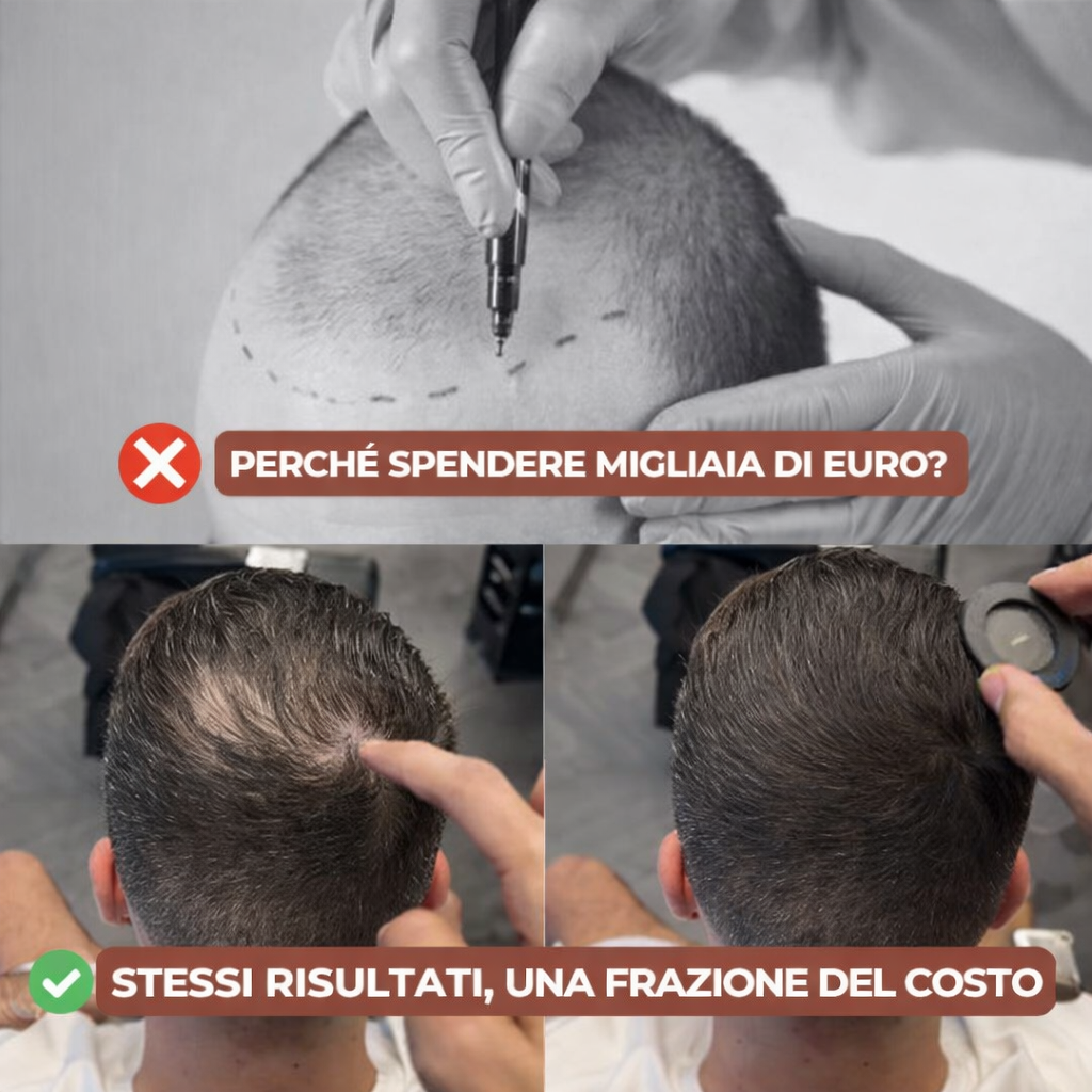 Hairo™ Mimetico impermeabile per la caduta dei capelli